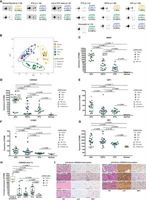 CDK4 phosphorylation status and rational use for combining CDK4/6 and BRAF/MEK inhibition in advanced thyroid carcinomas